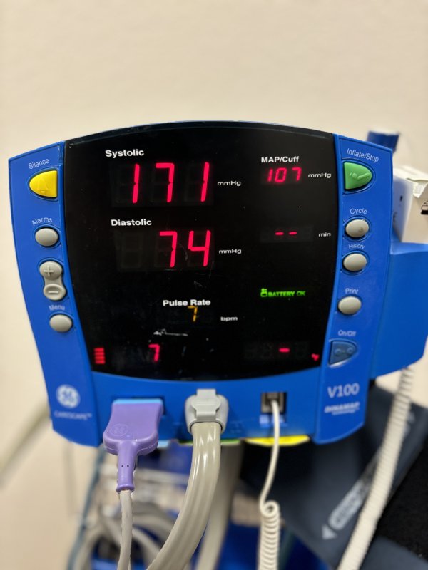 Carescape Dinamap Blood Pressure Monitor V100 