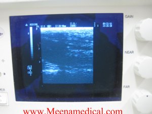 Medison Smartsound 800 Ultrasound 