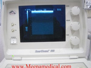 Medison Smartsound 800 Ultrasound 